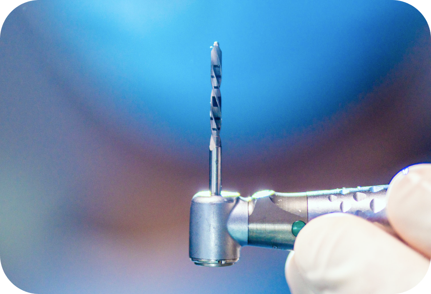 Pose d’un implant dentaire à Genève | Drs. Arnaud, Hugentobler & Oeggerli | Genève