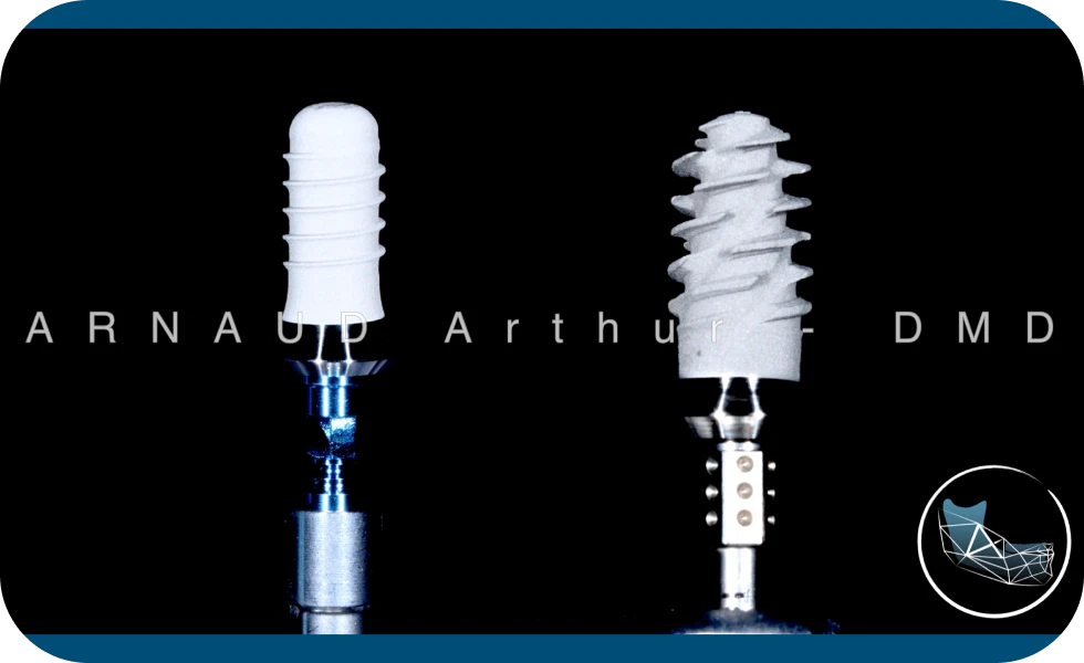 Implant unitaire Drs. Arnaud, Hugentobler & Oeggerli, Chirurgie orale | Genève