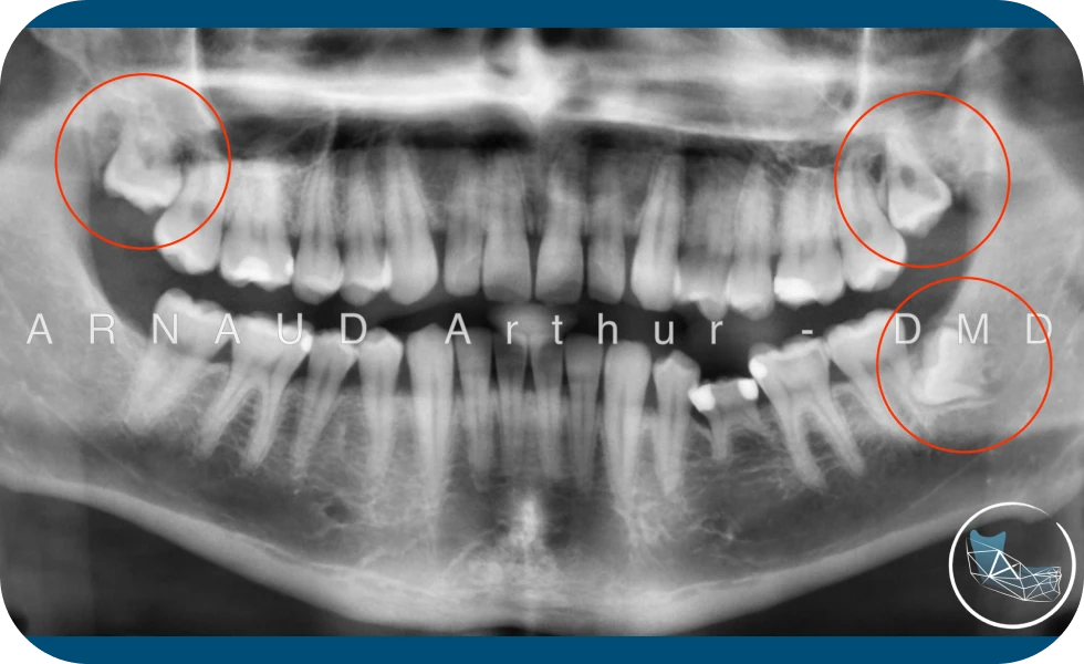 Centre de Chirurgie orale et Maxillo-faciale à Genève / Drs Arnaud, Hugentobler & Oeggerli