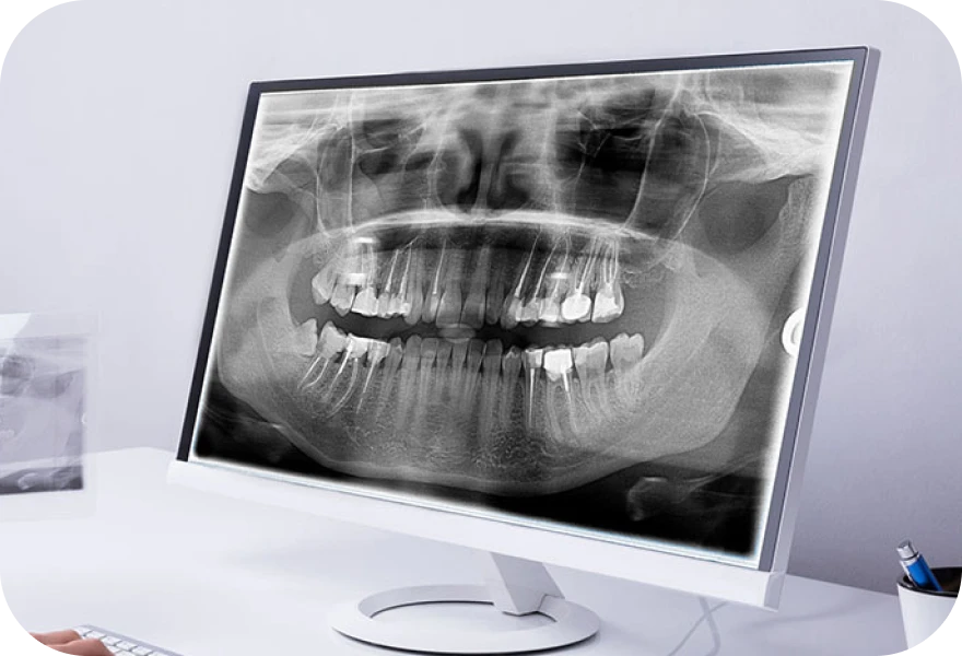 Dr. Arnaud, chirurgien oral à Genève et à Morges : dents de sagesse