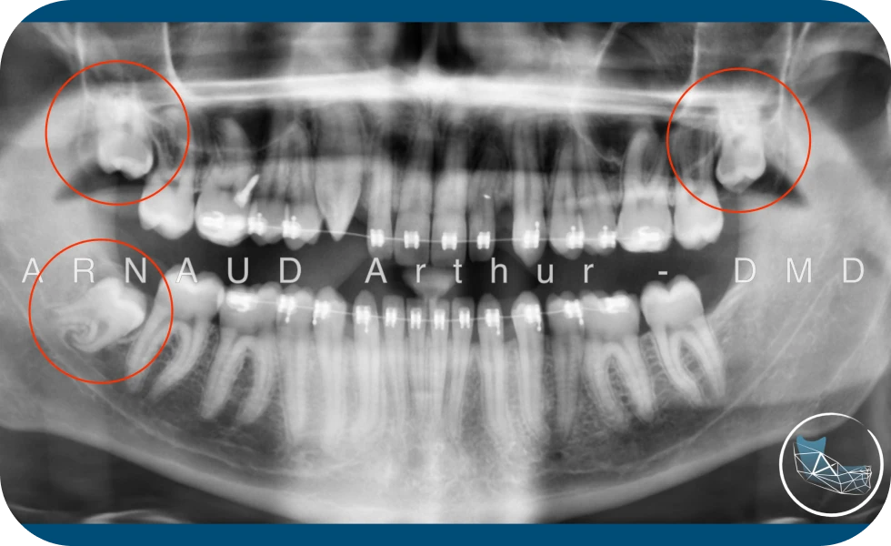 Centre de Chirurgie orale et Maxillo-faciale à Genève / Drs Arnaud, Hugentobler & Oeggerli