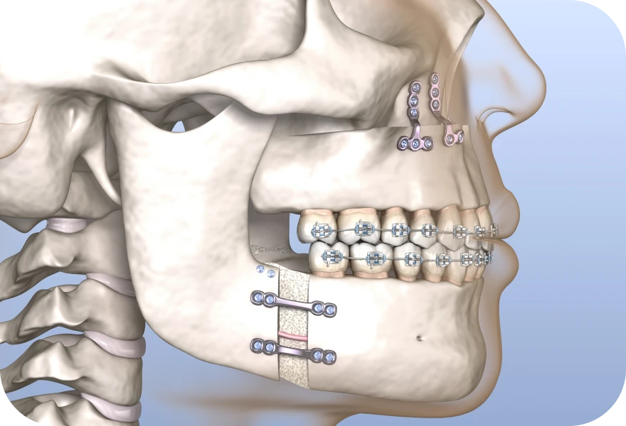 Chirurgie orthognathique Drs. Arnaud, Hugentobler & Oeggerli | Oral Surgery | Geneva