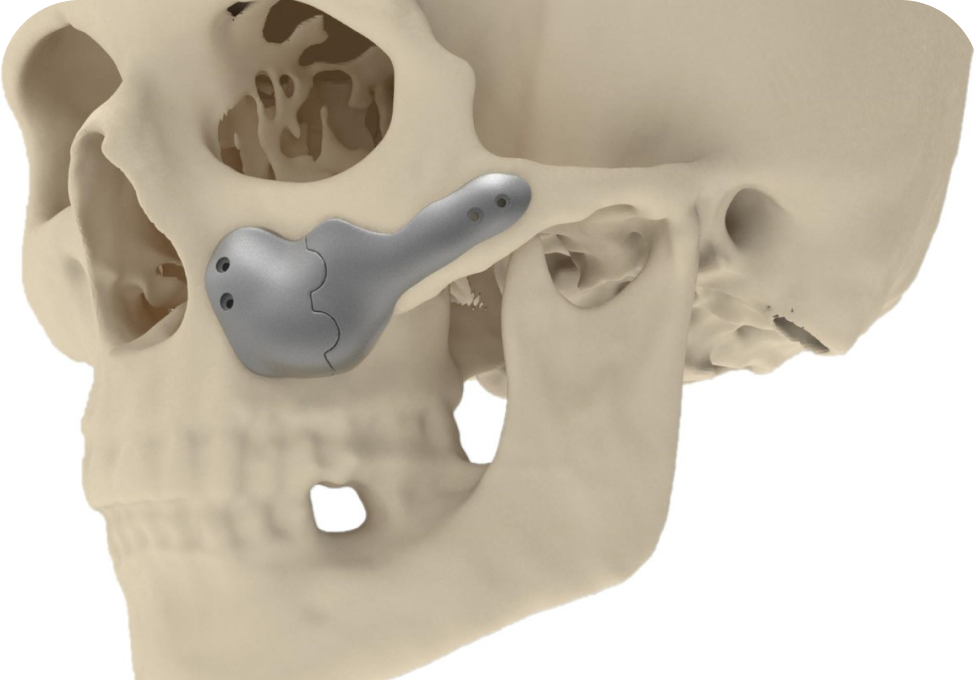 Implants faciaux Drs. Arnaud, Hugentobler & Oeggerli, Chirurgie orale | Genève