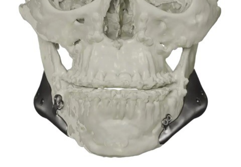 Implants faciaux Drs. Arnaud, Hugentobler & Oeggerli, Chirurgie orale | Genève