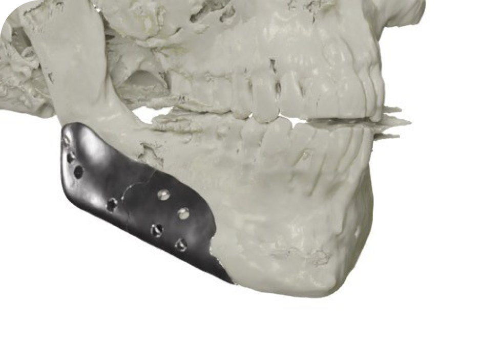 Implants faciaux Drs. Arnaud, Hugentobler & Oeggerli, Chirurgie orale | Genève